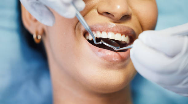 Best Chipped Tooth Repair Near Me  in Sidney, OH